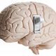 Illustration for article titled Scientists Have Located the Brain's On/Off Switch for Consciousness